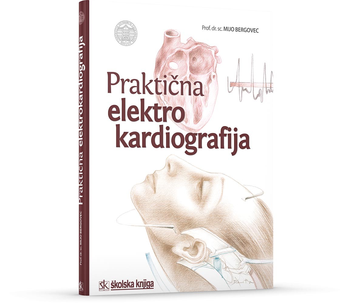 Praktična elektrokardiografija