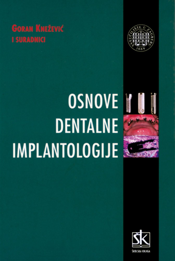 Osnove dentalne implantologije