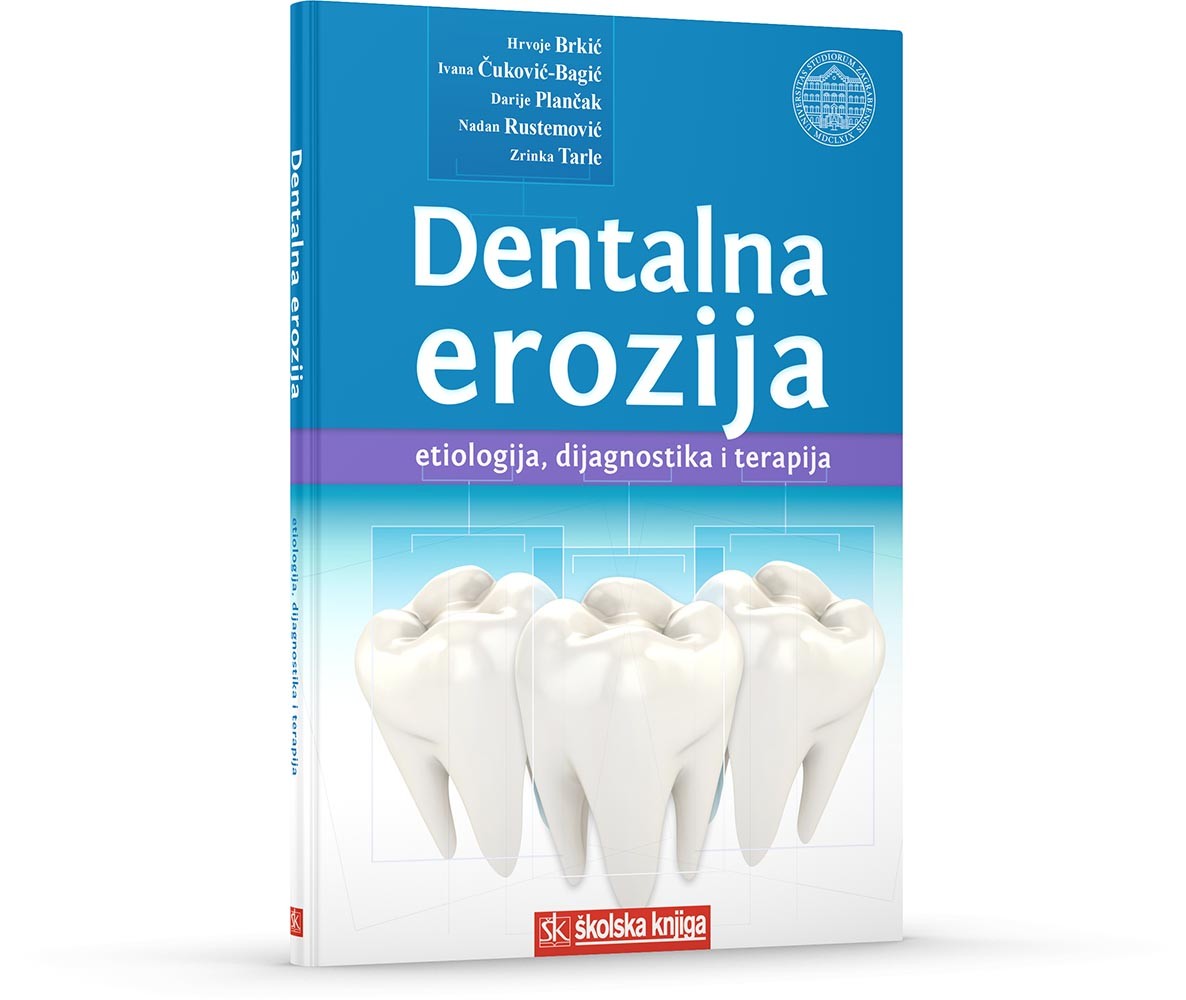 Dentalna erozija - Etiologija, dijagnostika i terapija